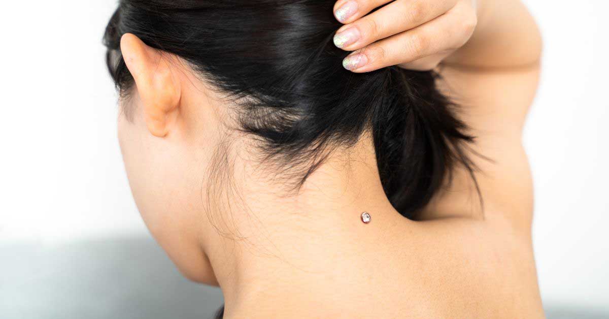 Piercing Microdermal: Conheça Riscos, Cicatrização e Estilos